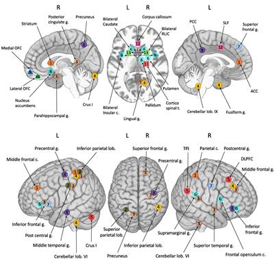 Neural Signature of DCD: A Critical Review of MRI Neuroimaging Studies